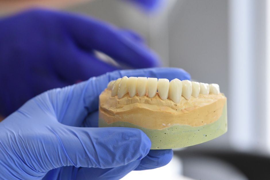 implantes dentales precio