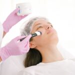 chemical peel treatment