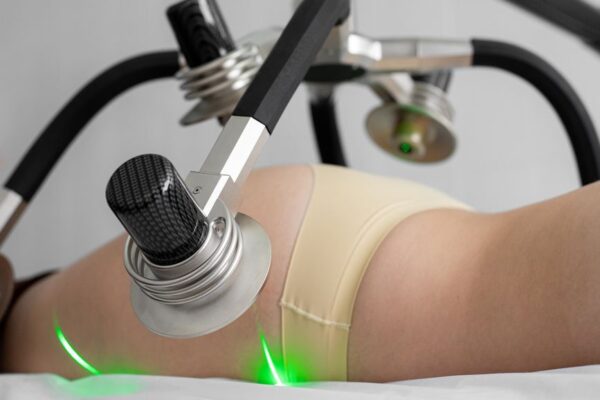 liposuction cost